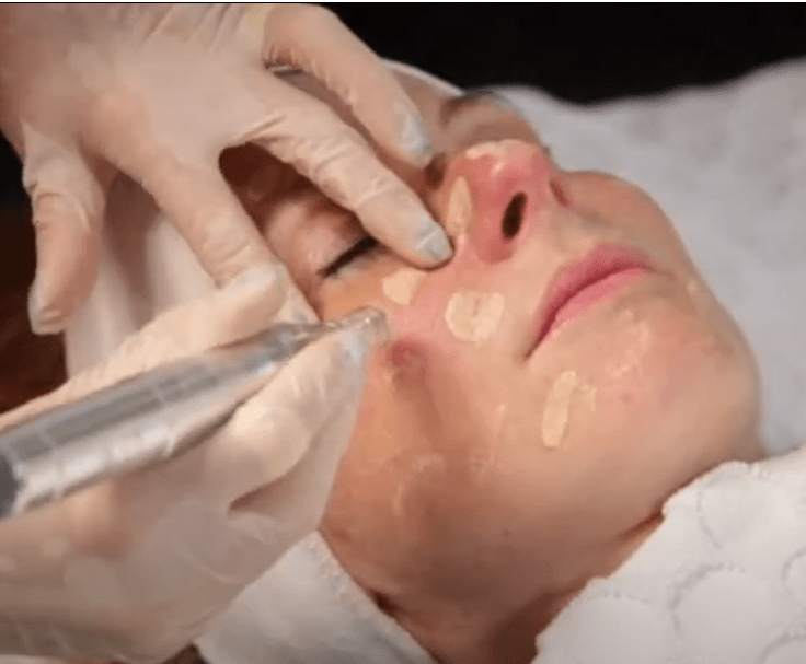 BB Glow Gesichtsbehandlung Stuttgart &ndash; ebenm&auml;&szlig;iger Teint und nat&uuml;rlicher Glow im House of Glam