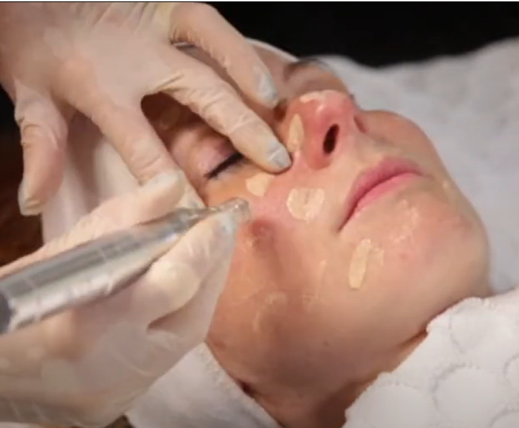 BB Glow Gesichtsbehandlung Stuttgart – ebenmäßiger Teint und natürlicher Glow im House of Glam