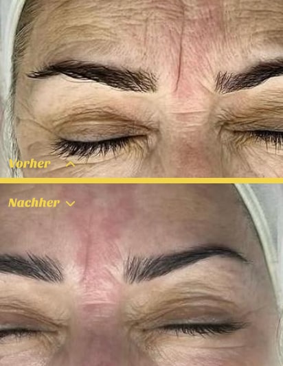 Luxuri&ouml;se Hydrafacial Gesichtsbehandlung in Stuttgart f&uuml;r gesunde Haut